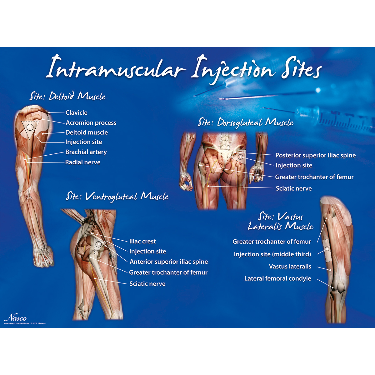 Intramuscular Injection Sites Poster W LF